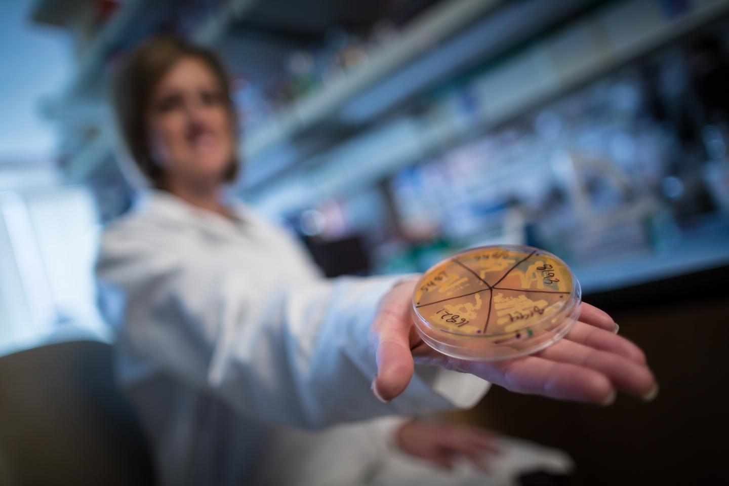 The Microbiome and Obesity