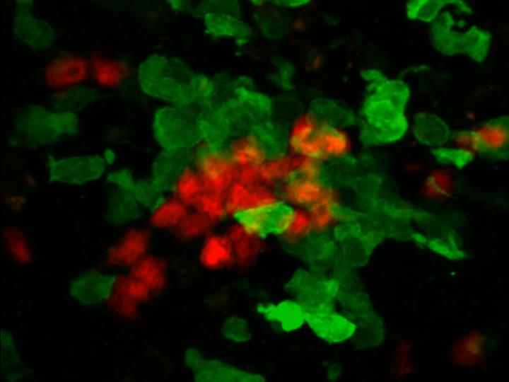 Once Killer Cells (Red)