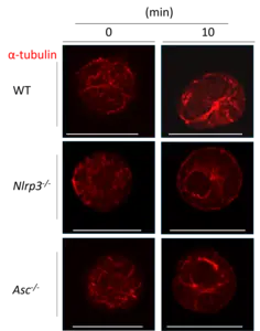 Role of inflammasome proteins: NLRP3 and ASC