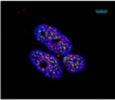 RUNK Proteins and Fanconi Anemia Factor