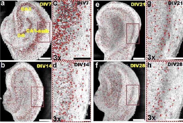 Representative Optical Coherence Microscopy Images Obtained from Brain Cultures