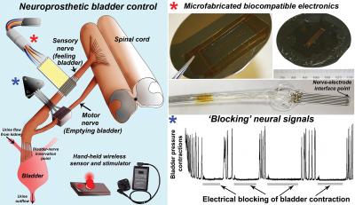 Neuroprosthetic Device Tells Bladder when to 'Go'