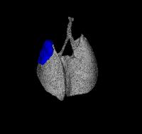 MicroCT of Tumor in sox2/lkb1 Mouse Lung