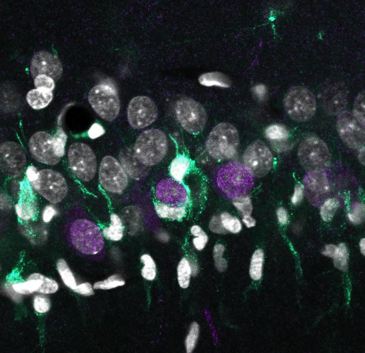 Uneven Accumulation of Microglia around the Surface of Superficial CA1 Neurons