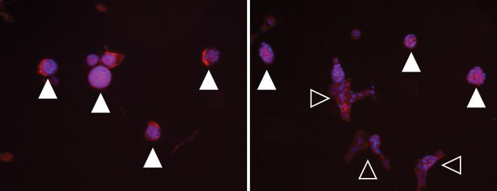 Mammary Cells Respond to Stiffening Environment