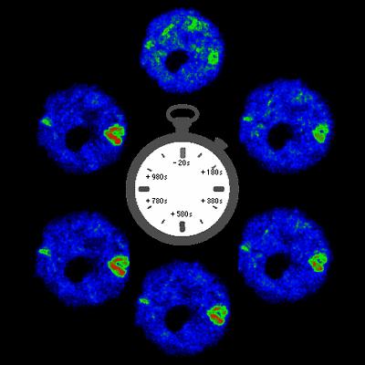 Gene Transcription Activation