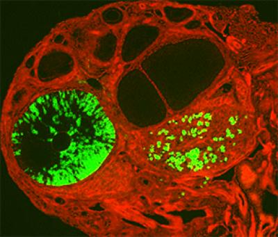 Different Eggs in Adolescent Girls and Adult Women