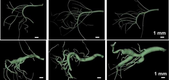 Mouse Model of Abdominal Aneurysms