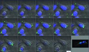 Bacterial Protein Found in the Urogenital Tract May Contribute to Reduced Fertility, Birth Defects