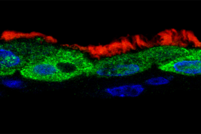 RSV-infected human respiratory cells