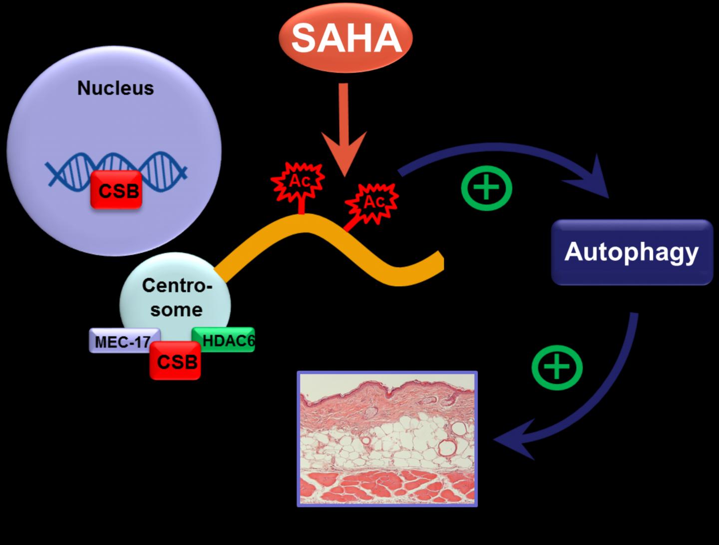 The HDAC Inhibitor SAHA Rescues the Skin Phenotype of CSB-deficient Mice