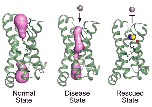 Normal, Diseased and Rescued Voltage Sensor