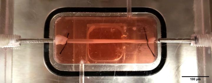 Engineered Blood Vessel