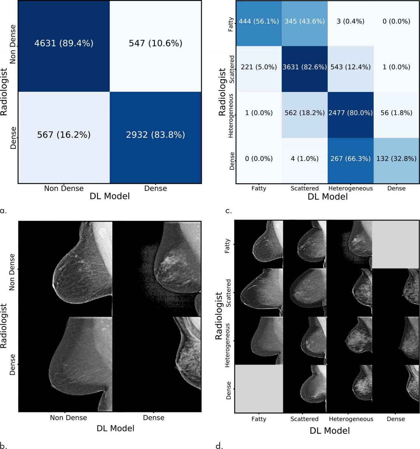 Comparison of the Original Interpreting Radiologist Assessment with the Deep Learning Model Assessme