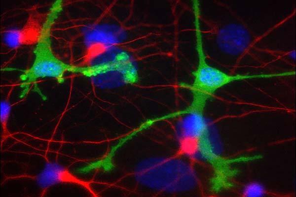 Antibody therapies for Parkinson's and Alzheimer's may cause harmful inflammation