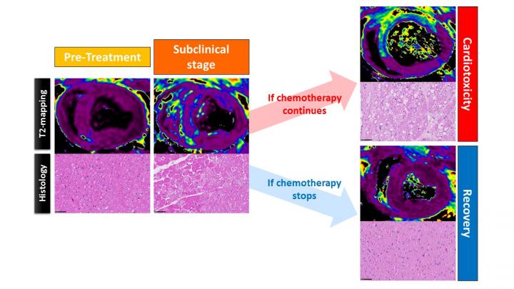 Magnetic Resonance Images