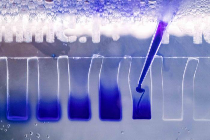 Proteins from breast cancer cells are separated and analysed at the University of Jena using gel electrophoresis; specifically, the loading of a gel with a protein extract produced from cells to which a blue dye has been added.