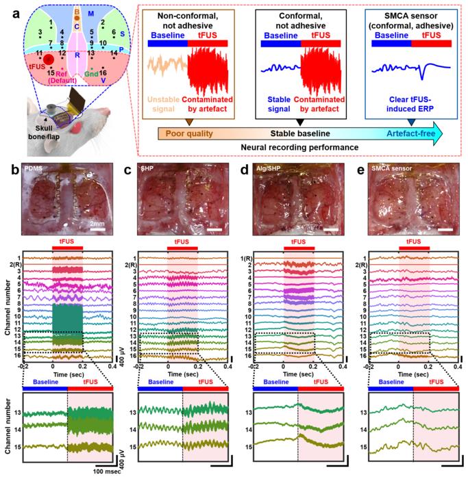 Figure 3. SMCA sensor allows for artefact-free neural recording