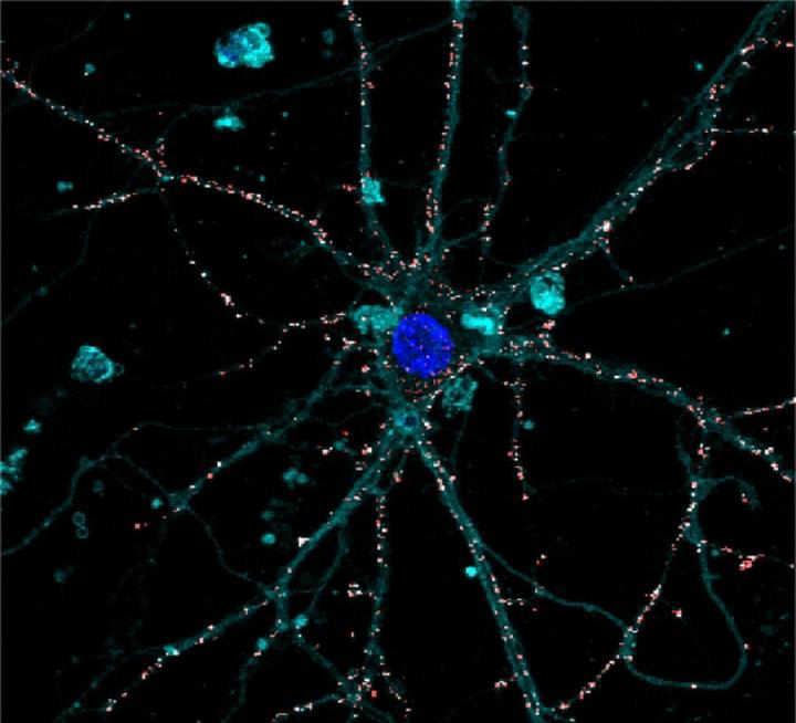 Artificial Liquid Retina