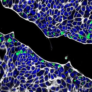 Chlamydia can infect gastrointestinal epithelial cells in the lab