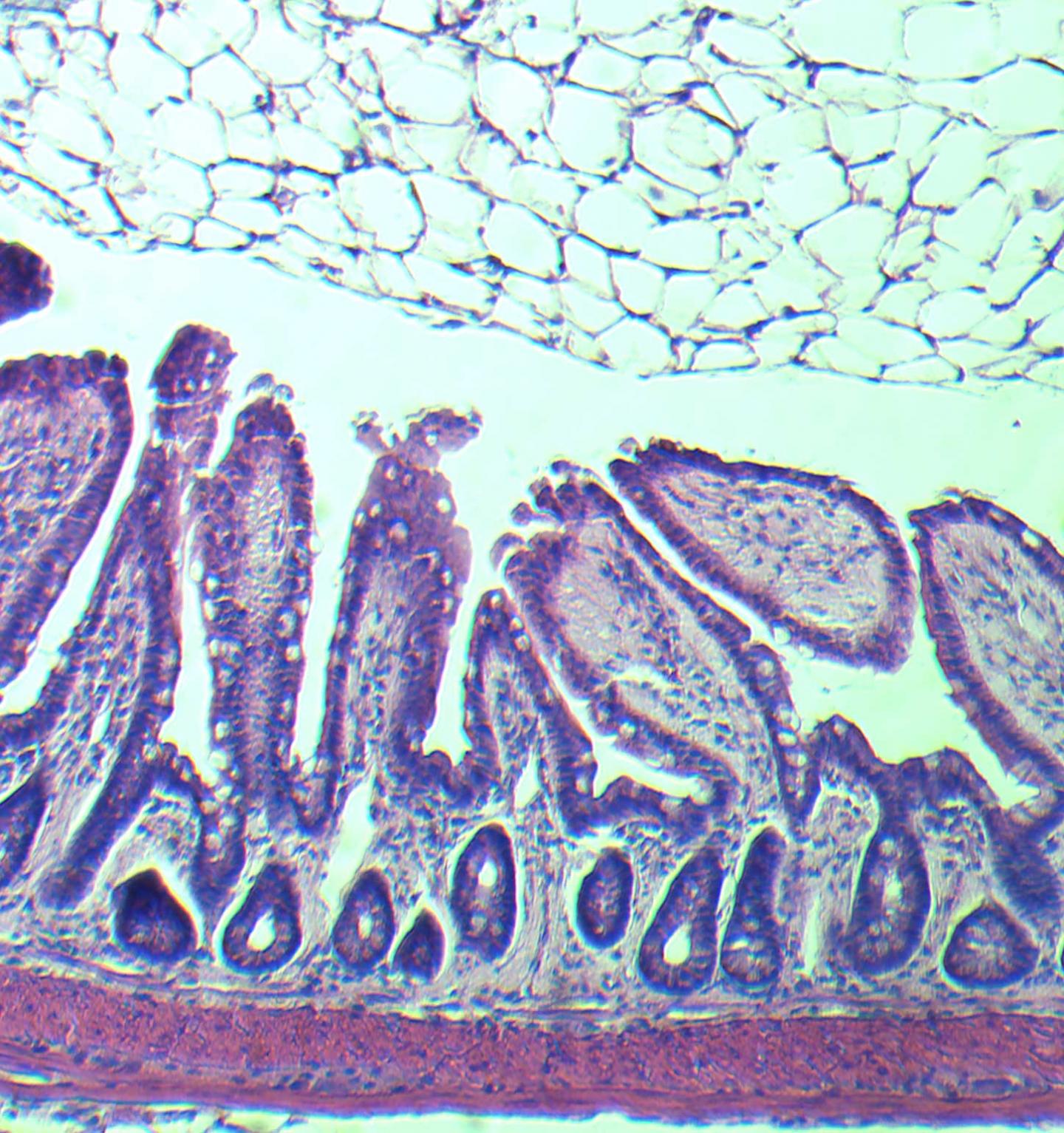 Villi from an Older Gut