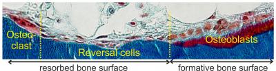 Reversal Cells