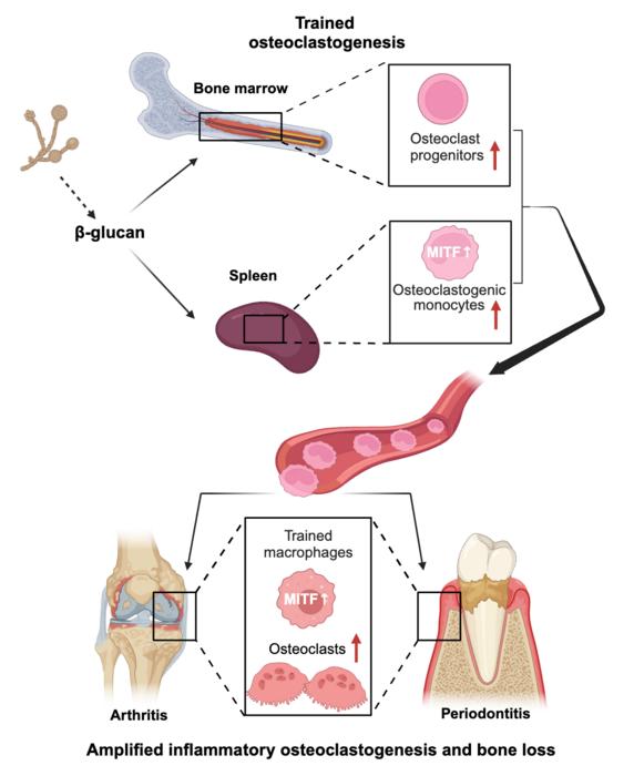 Schematic of trained innate immunity and the generation of osteoclasts