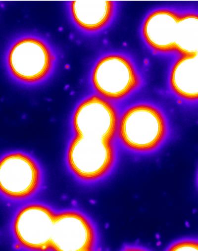 Scripps Research Scientists Watch Membrane Fission in Real Time