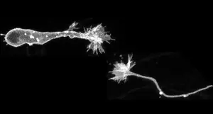 Deciphering the tip of migrating neurons: Dis - Vimarsana News