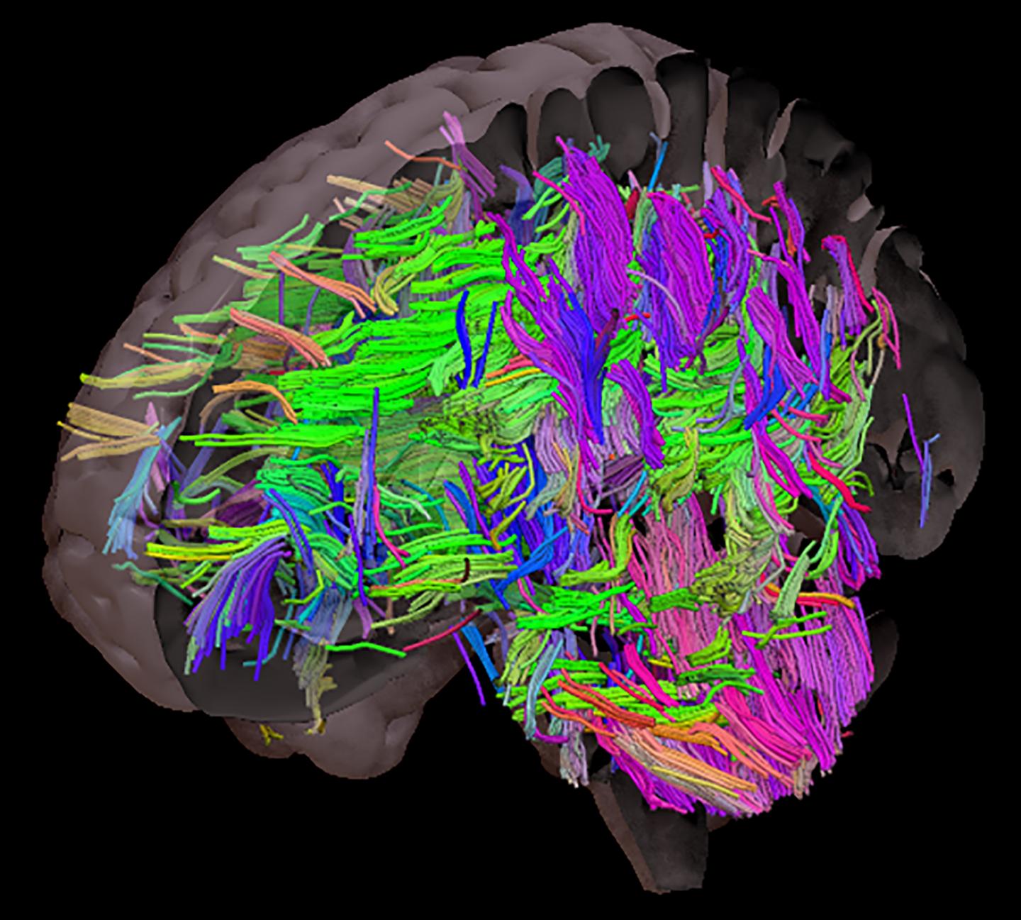 White matter tracts in the brain