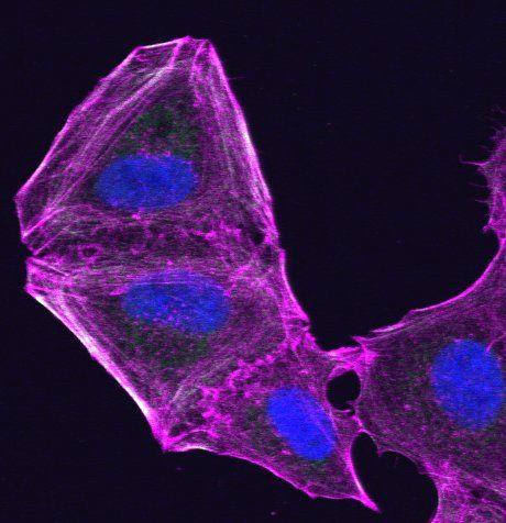 Drug-Resistant Melanoma Cell