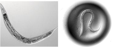 New Screening Method Uses Tiny Worms to Seek Serum for Healthy Aging