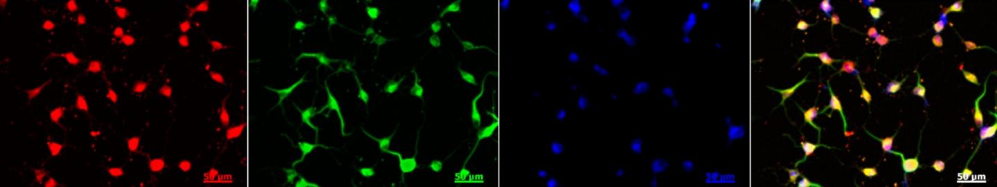 From Skin to Brain: Stem Cells Without Genetic Modification (1 of 2)