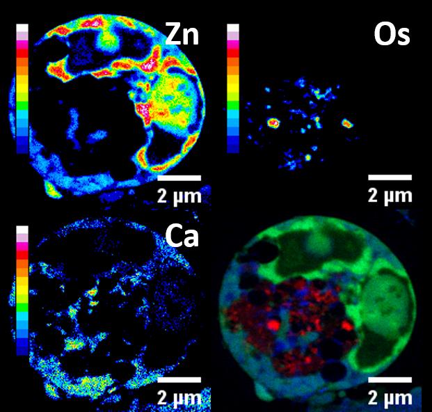Ovarian Cancer Cells under Nano-Focus