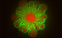 Bacterial Cultures Form Flower Patterns
