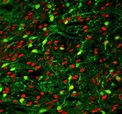 Differentiation of Human iPSC-MGE Cells (Red) into Parvalbumin Positive Interneurons (Green) 2