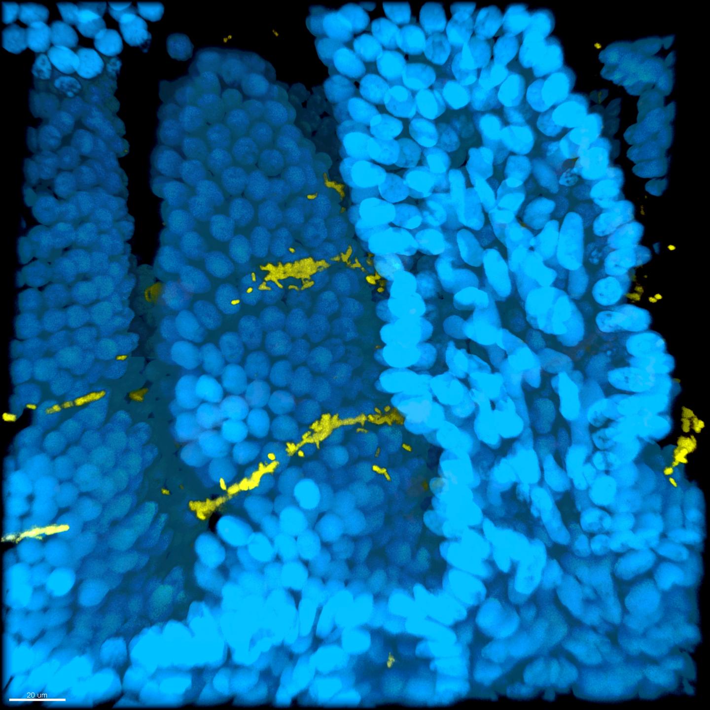 Cholera Colonization of Intestine