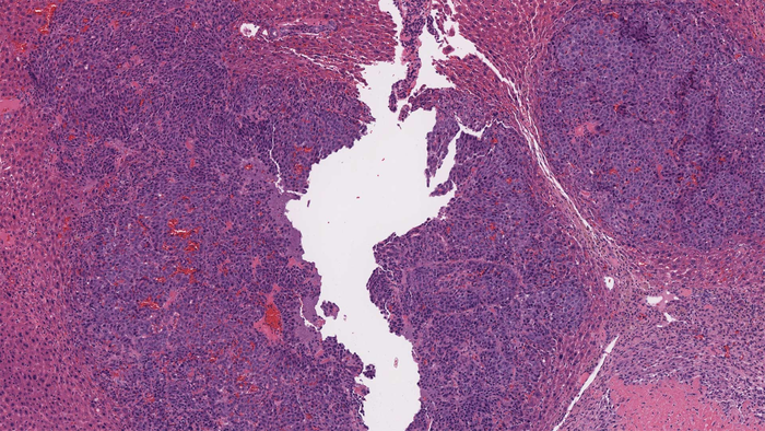 Mouse liver tissue with tumor