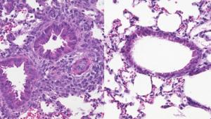 ILC2s in the lungs