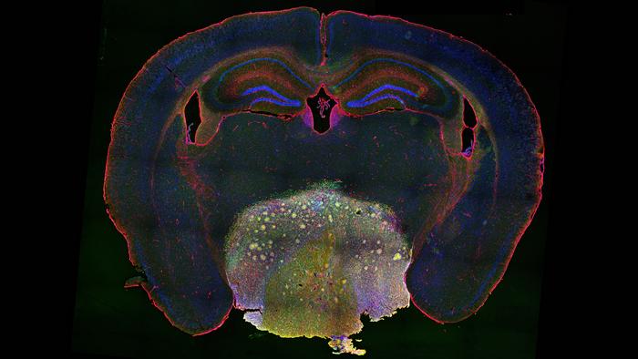 Mouse craniopharyngioma