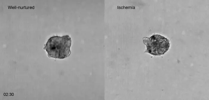 Lung cancer cells grown inside the 3MIC