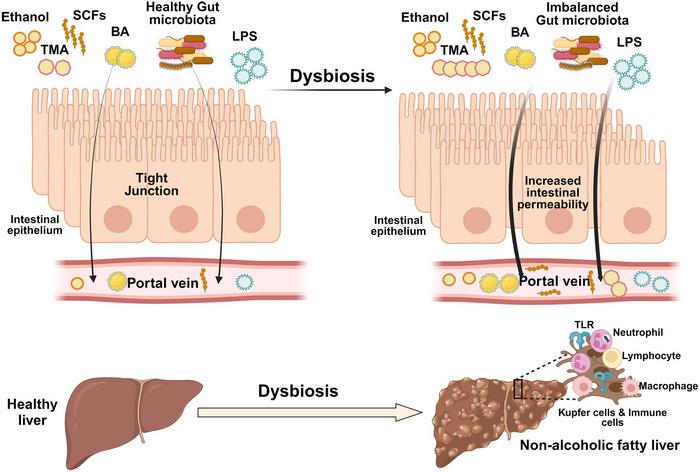 Schematic representation of how the gut microbiota contributes to the development of NAFLD