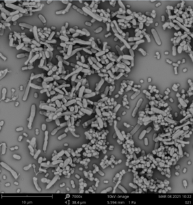 Scanning EM of Klebsiella pneumoniae and Acinetobacter baumannii growing together in a biofilm