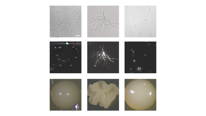 Strains of Candida auris in yeast and filamentous form