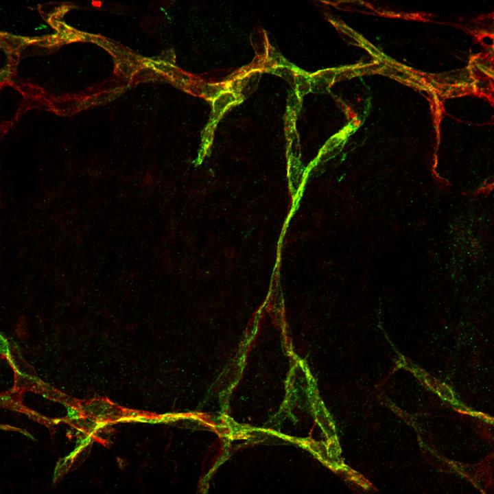 Blood Vessel Growth Differs Between Tissues, Opening Door to Tissue-Specific Therapy (1 of 4)