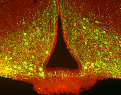 Melanocortin Neurons in the Brain that Promote Satiety