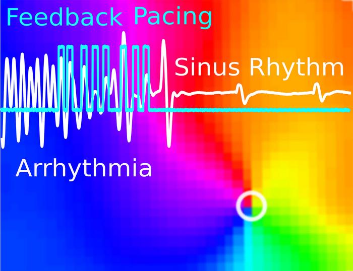 Arrhythmia_optogenetics