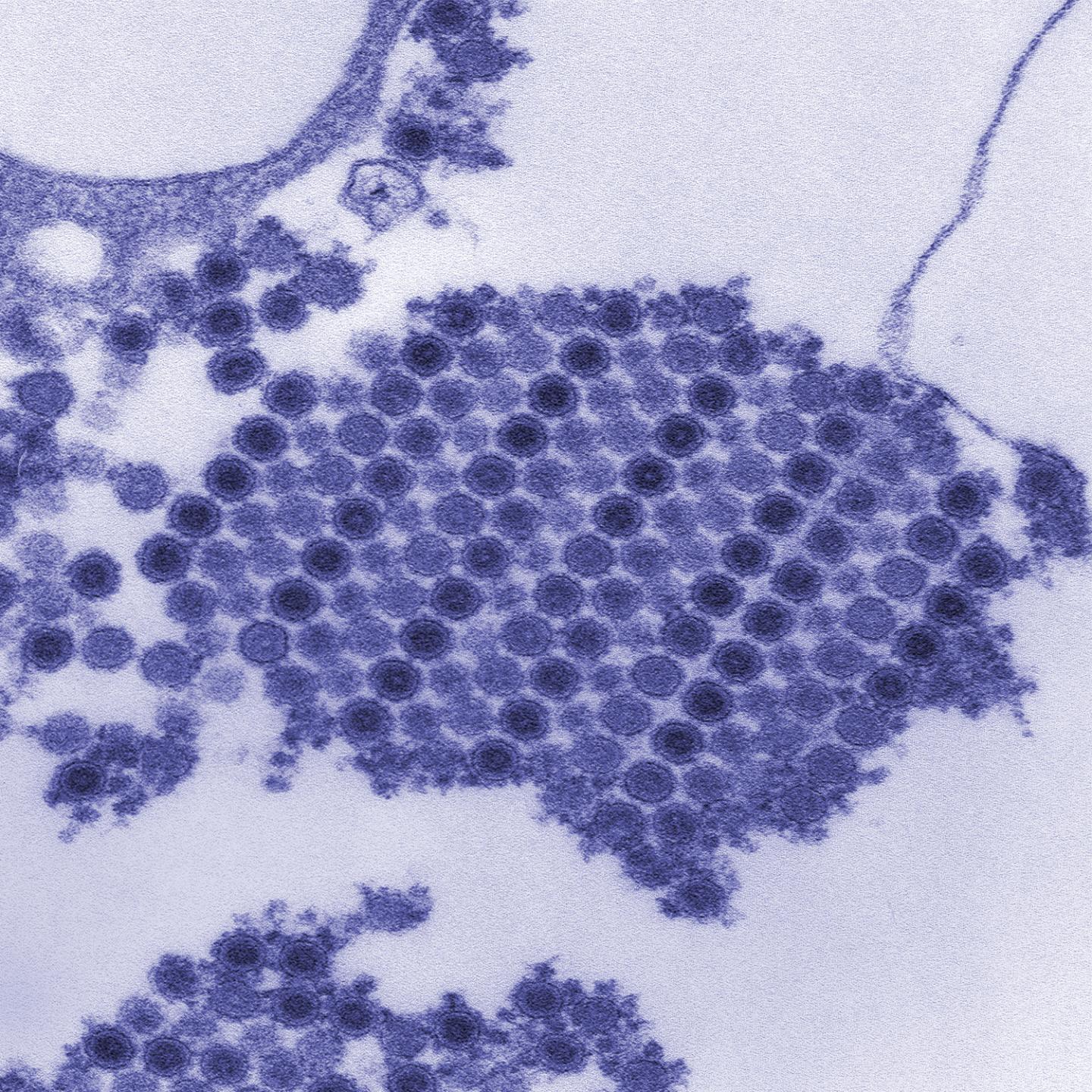 Chikungunya Virus