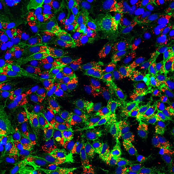 Infected liver cells