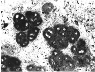Biofilm Lung Infection [IMAGE] | EurekAlert! Science News Releases